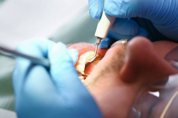 Best Emergency Dental Care for Trauma or Injury in Dansville, NY