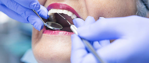 Best Emergency Broken Tooth Repair in Dansville, NY